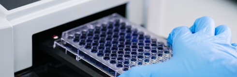 SARS-CoV-2 qRT-PCR Detection Assay